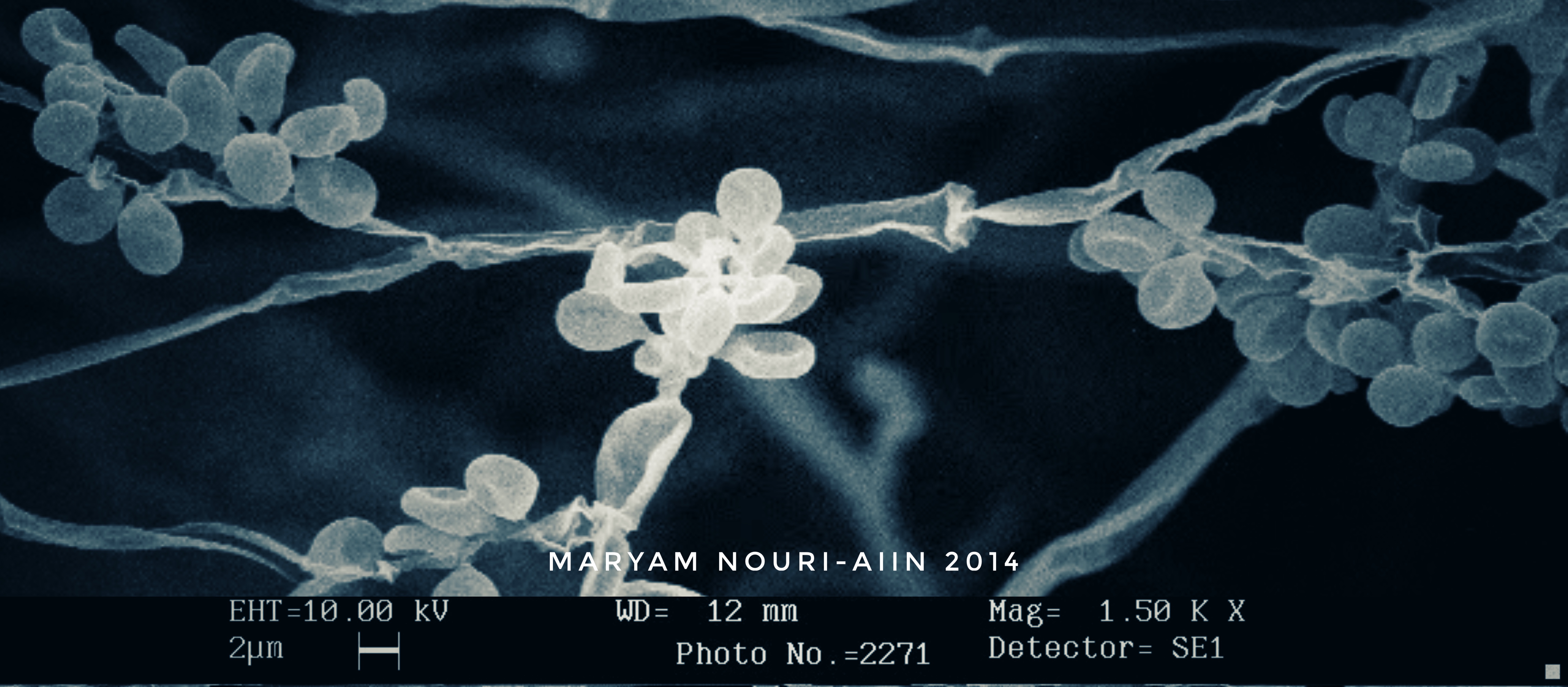 Fungal infection and microbiome assay